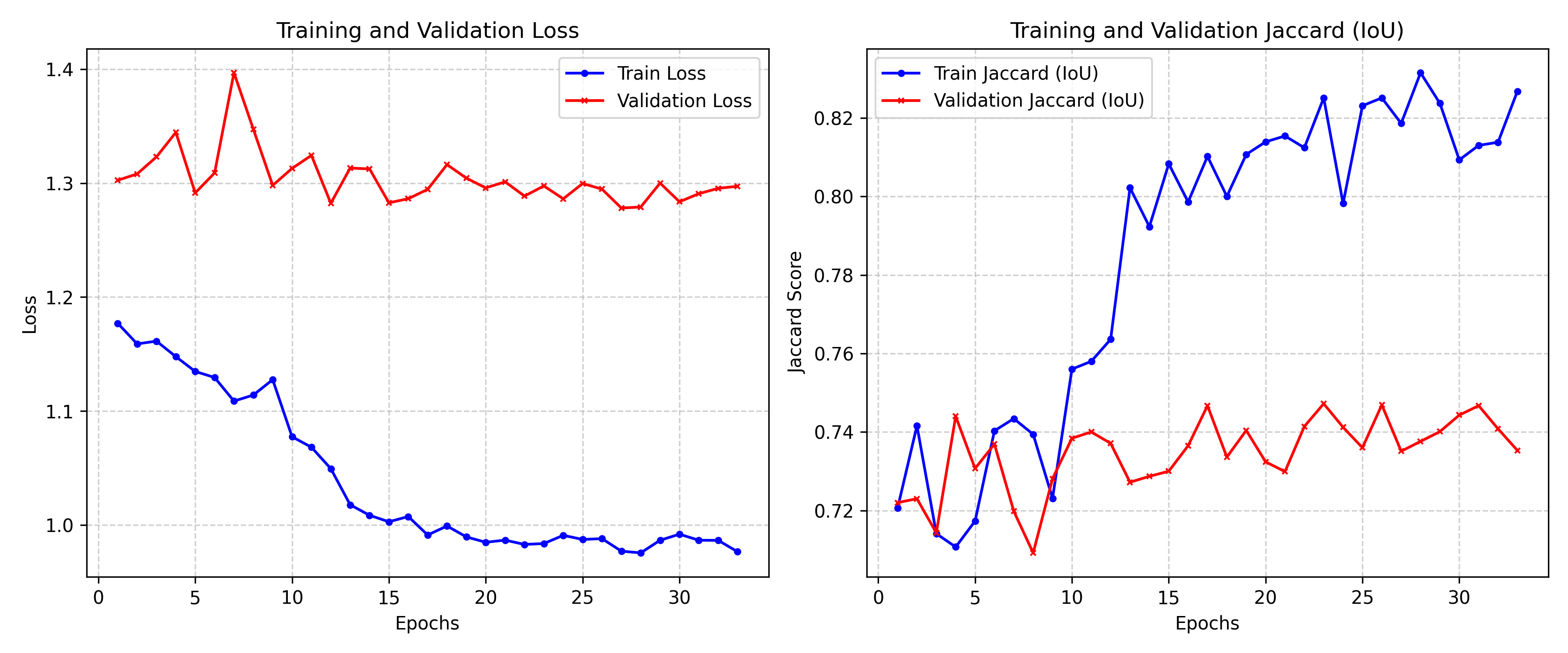 BUSI training and validation curves